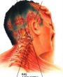 What are headache treatment